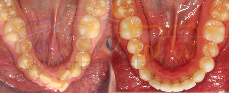 Ortodonti hedefler